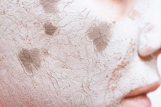 Лечение старческого зуда кожи: основные методы и рекомендации